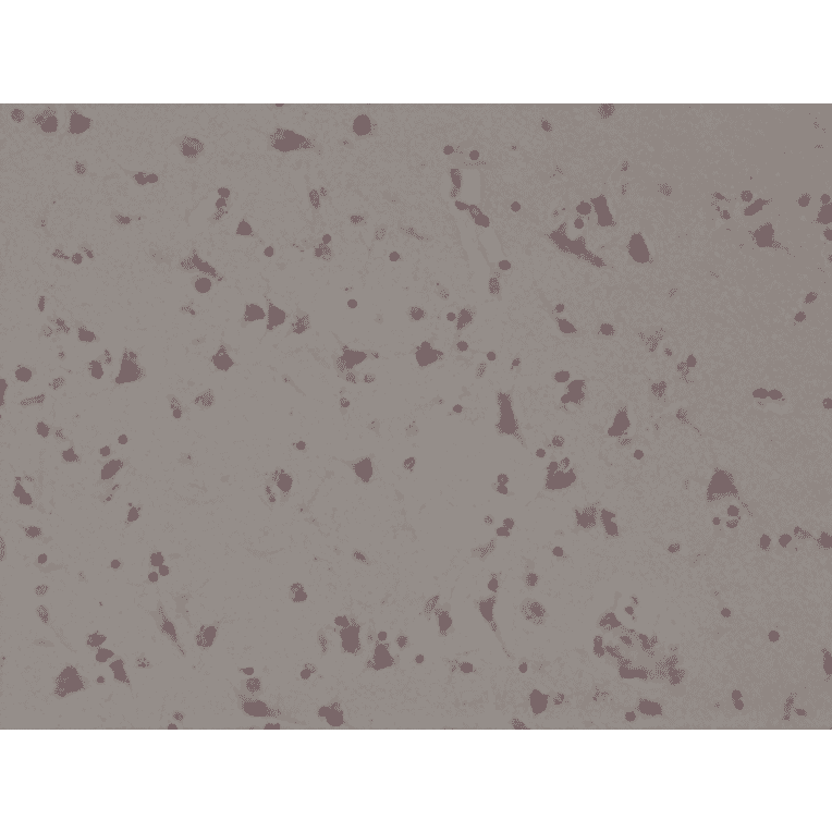 Immunohistochemistry - Anti-SATB2 Antibody [RM365] (A121296) - Antibodies.com