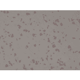 Immunohistochemistry - Anti-SATB2 Antibody [RM365] (A121296) - Antibodies.com