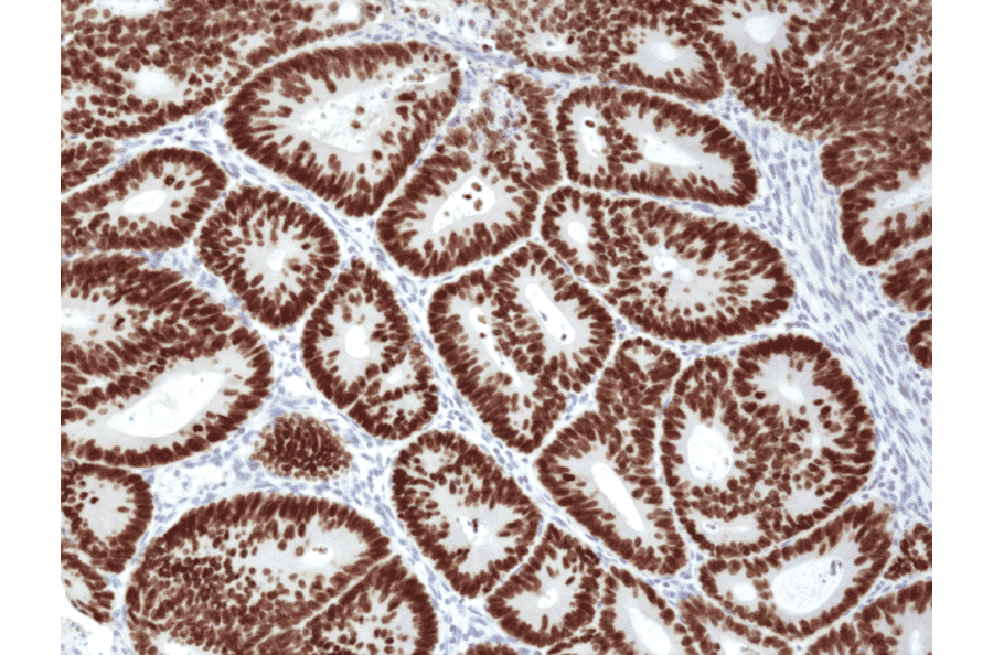 Immunohistochemistry - Anti-SATB2 Antibody [RM365] (A121460) - Antibodies.com