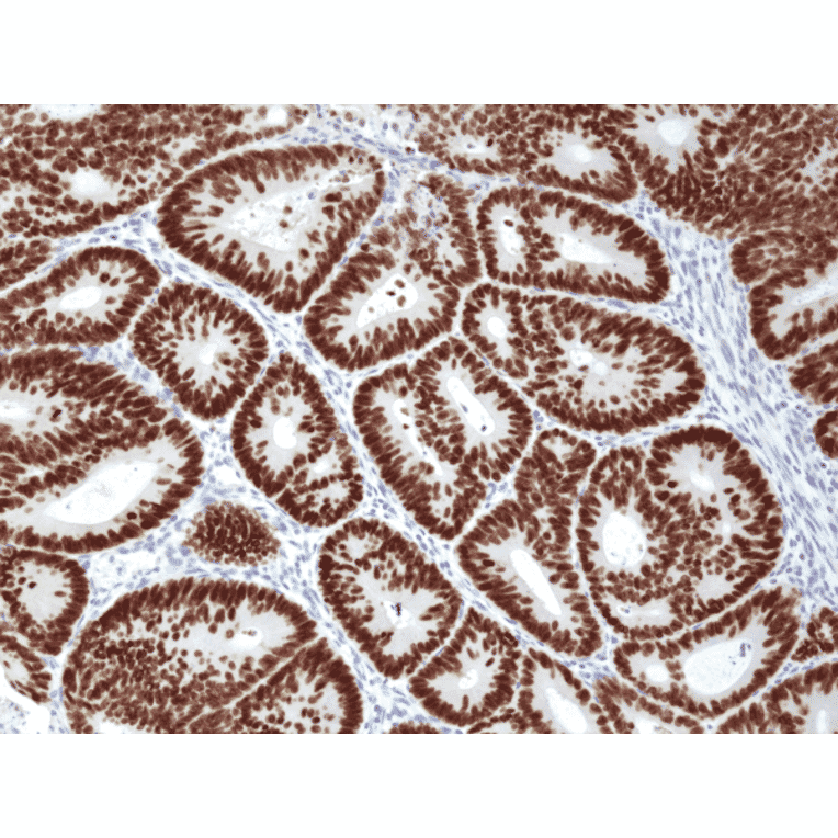 Immunohistochemistry - Anti-SATB2 Antibody [RM365] (A121460) - Antibodies.com