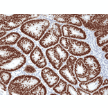 Immunohistochemistry - Anti-SATB2 Antibody [RM365] (A121460) - Antibodies.com