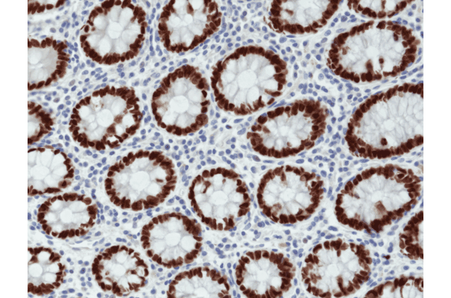 Immunohistochemistry - Anti-SATB2 Antibody [RM365] (A121460) - Antibodies.com