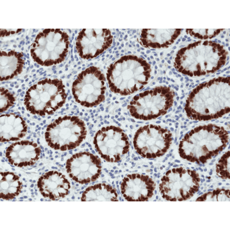 Immunohistochemistry - Anti-SATB2 Antibody [RM365] (A121460) - Antibodies.com