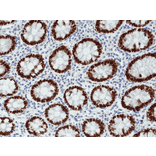 Immunohistochemistry - Anti-SATB2 Antibody [RM365] (A121460) - Antibodies.com