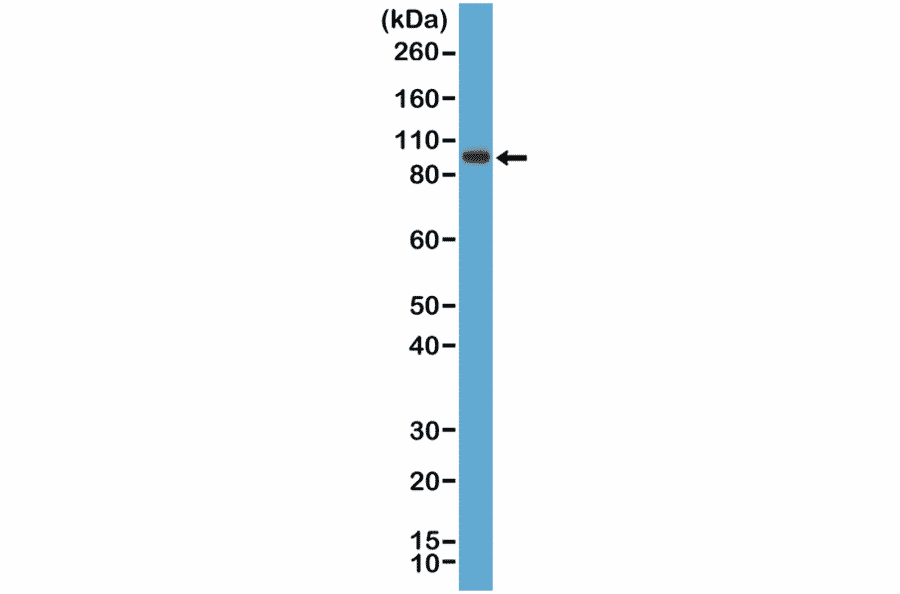 Western Blot - Anti-SATB2 Antibody [RM365] (A121460) - Antibodies.com