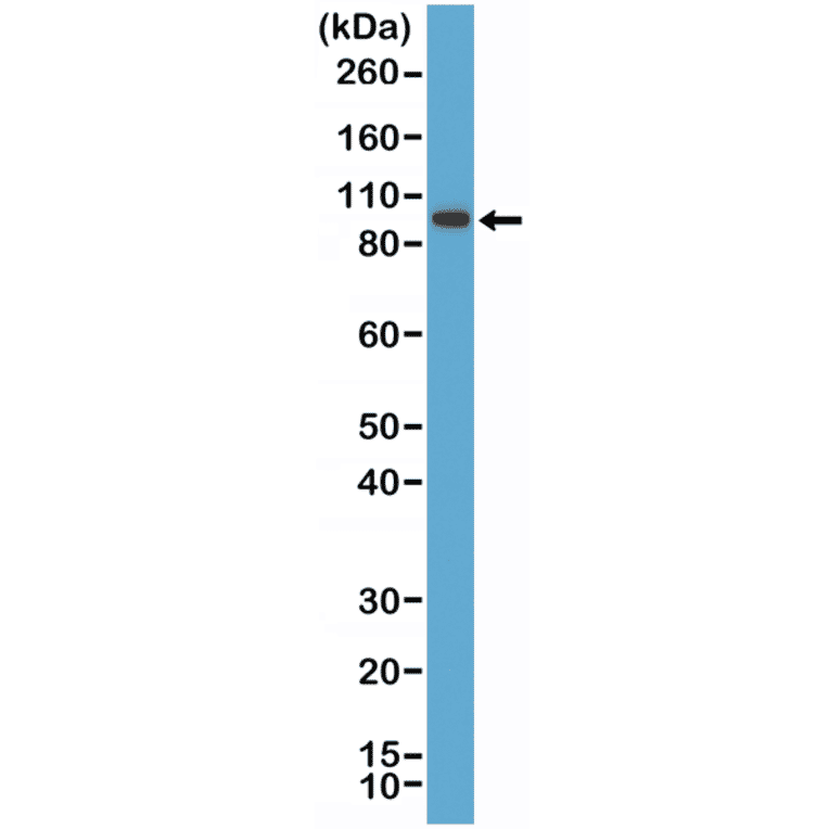 Western Blot - Anti-SATB2 Antibody [RM365] (A121460) - Antibodies.com