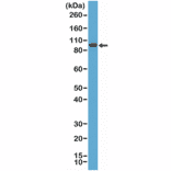Western Blot - Anti-SATB2 Antibody [RM365] (A121460) - Antibodies.com