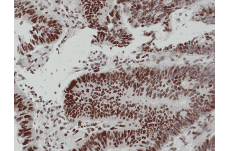 Immunohistochemistry - Anti-MSH6 Antibody [RM376] (A121462) - Antibodies.com