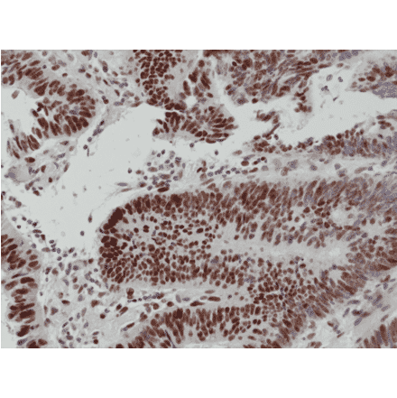 Immunohistochemistry - Anti-MSH6 Antibody [RM376] (A121462) - Antibodies.com