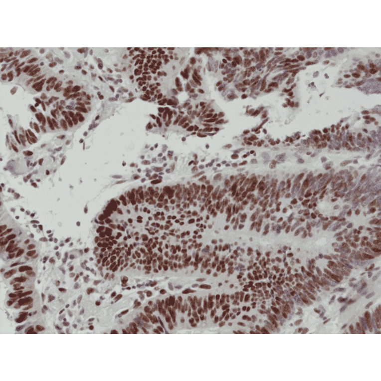 Immunohistochemistry - Anti-MSH6 Antibody [RM376] (A121462) - Antibodies.com
