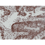 Immunohistochemistry - Anti-MSH6 Antibody [RM376] (A121462) - Antibodies.com