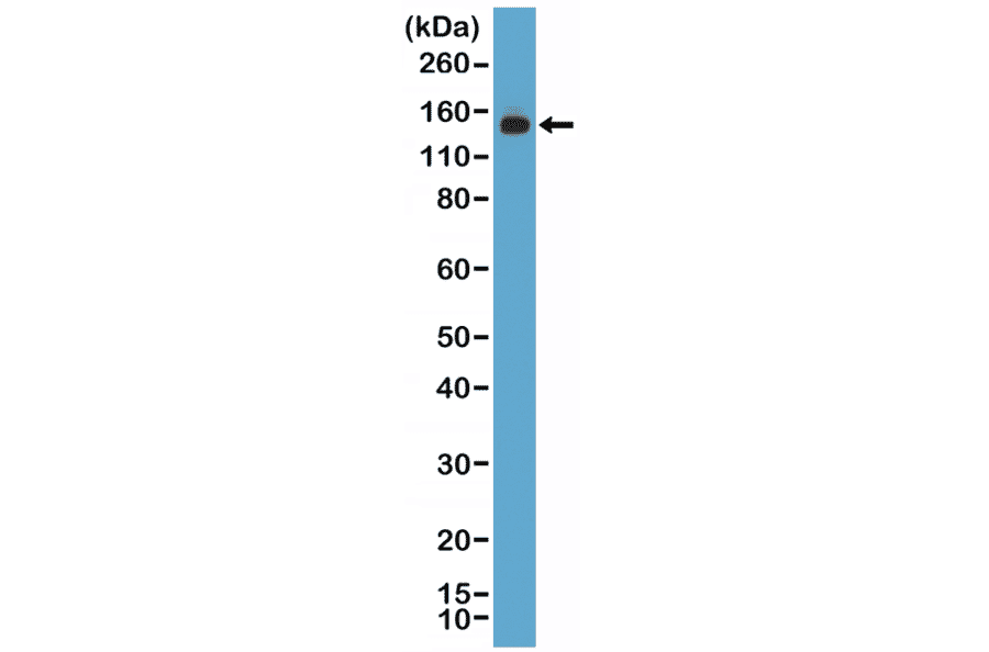 Western Blot - Anti-MSH6 Antibody [RM376] (A121461) - Antibodies.com