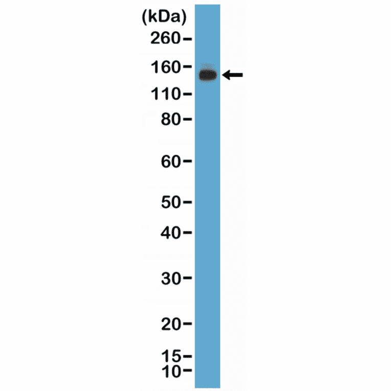 Western Blot - Anti-MSH6 Antibody [RM376] (A121461) - Antibodies.com