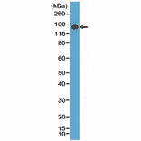 Western Blot - Anti-MSH6 Antibody [RM376] (A121461) - Antibodies.com