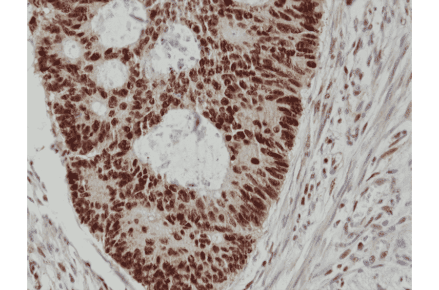 Immunohistochemistry - Anti-MSH2 Antibody [RM375] (A121390) - Antibodies.com