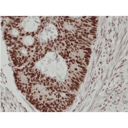 Immunohistochemistry - Anti-MSH2 Antibody [RM375] (A121390) - Antibodies.com