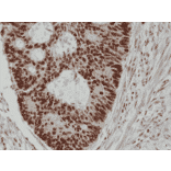Immunohistochemistry - Anti-MSH2 Antibody [RM375] (A121390) - Antibodies.com