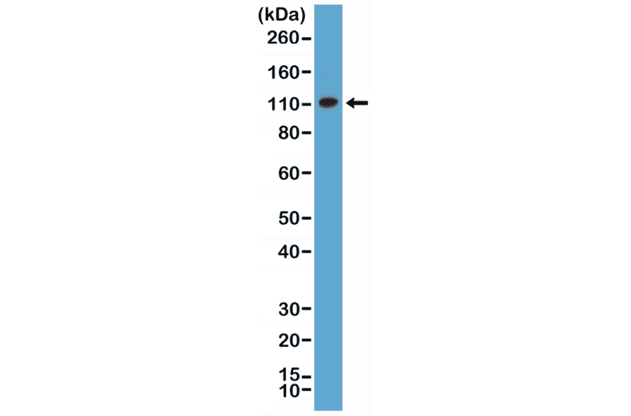 Western Blot - Anti-MSH2 Antibody [RM375] (A121462) - Antibodies.com