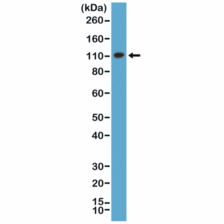 Western Blot - Anti-MSH2 Antibody [RM375] (A121462) - Antibodies.com