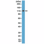 Western Blot - Anti-MSH2 Antibody [RM375] (A121462) - Antibodies.com
