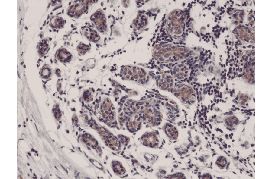Immunohistochemistry - Anti-DIABLO Antibody [RM271] (A121249) - Antibodies.com