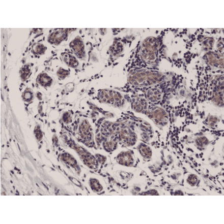 Immunohistochemistry - Anti-DIABLO Antibody [RM271] (A121249) - Antibodies.com