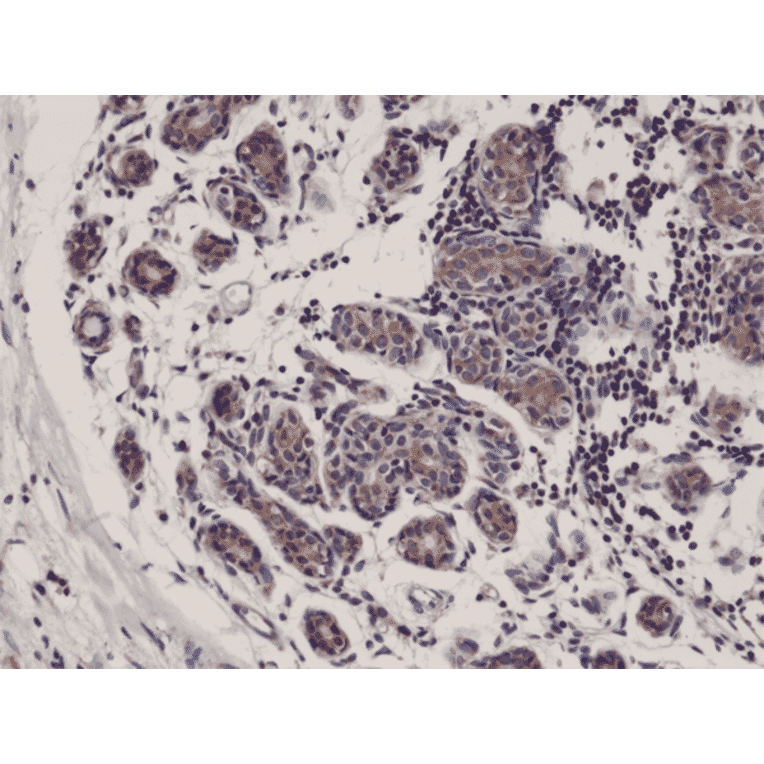 Immunohistochemistry - Anti-DIABLO Antibody [RM271] (A121249) - Antibodies.com