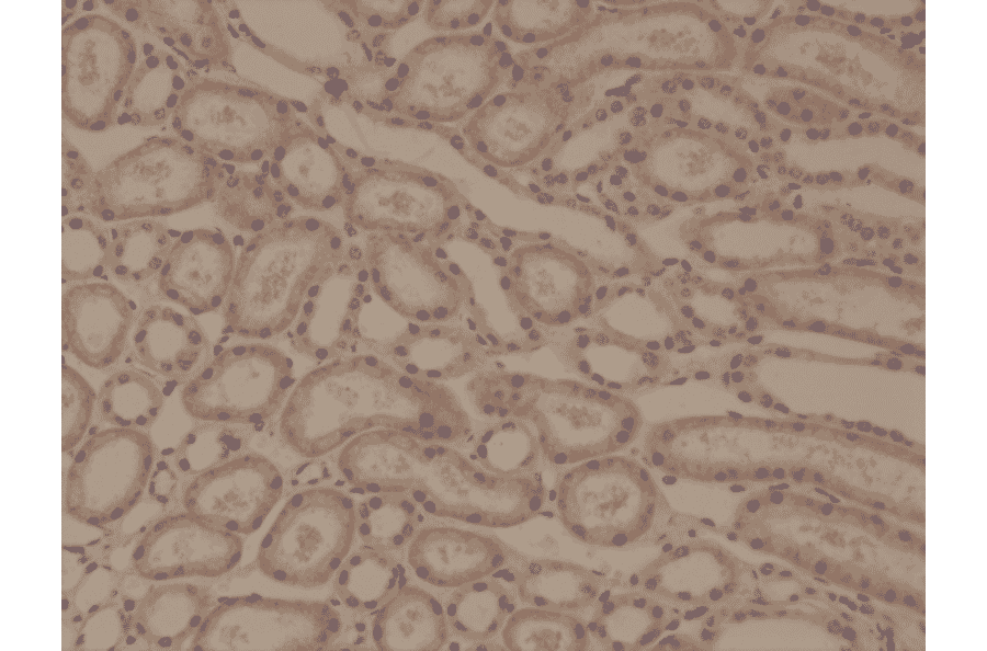 Immunohistochemistry - Anti-delta 1 Catenin Antibody [RM353] (A121452) - Antibodies.com