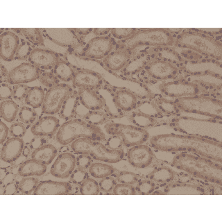 Immunohistochemistry - Anti-delta 1 Catenin Antibody [RM353] (A121452) - Antibodies.com