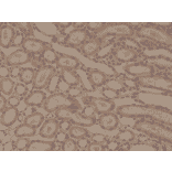Immunohistochemistry - Anti-delta 1 Catenin Antibody [RM353] (A121452) - Antibodies.com