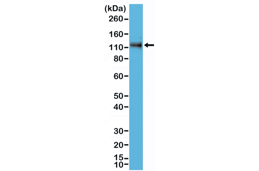 Western Blot - Anti-delta 1 Catenin Antibody [RM353] (A121464) - Antibodies.com