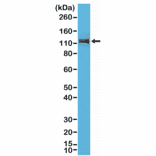 Western Blot - Anti-delta 1 Catenin Antibody [RM353] (A121464) - Antibodies.com