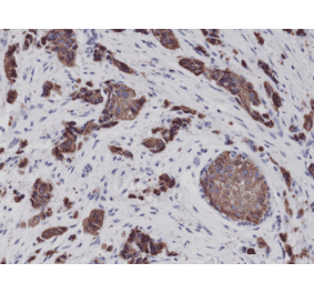 Immunohistochemistry - Anti-Cytokeratin 8 Antibody [RM266] (A121370) - Antibodies.com