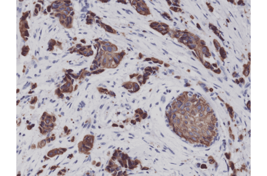 Immunohistochemistry - Anti-Cytokeratin 8 Antibody [RM266] (A121370) - Antibodies.com