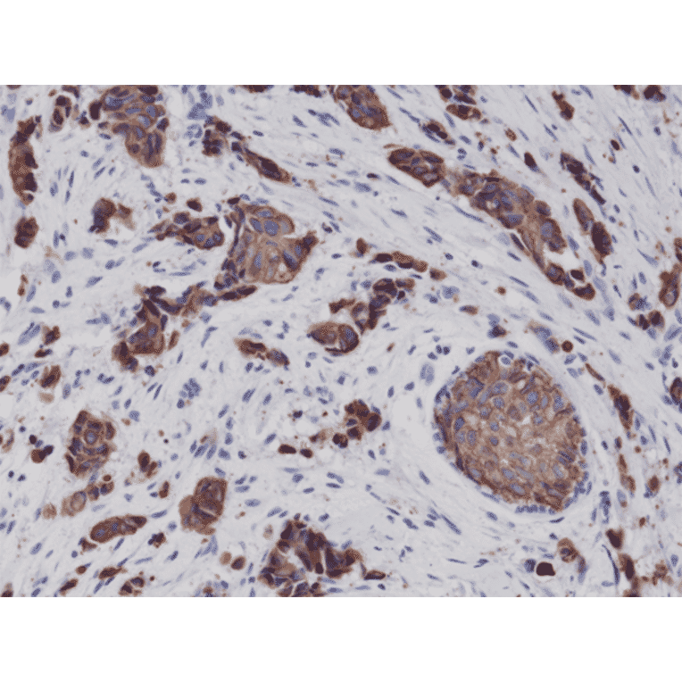 Immunohistochemistry - Anti-Cytokeratin 8 Antibody [RM266] (A121370) - Antibodies.com