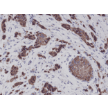 Immunohistochemistry - Anti-Cytokeratin 8 Antibody [RM266] (A121370) - Antibodies.com