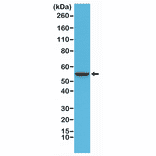 Western Blot - Anti-Cytokeratin 8 Antibody [RM266] (A121465) - Antibodies.com