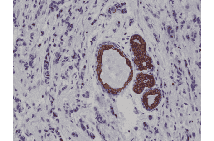 Immunohistochemistry - Anti-Cytokeratin 7 Antibody [RM284] (A121469) - Antibodies.com