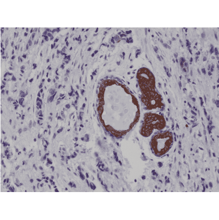 Immunohistochemistry - Anti-Cytokeratin 7 Antibody [RM284] (A121469) - Antibodies.com