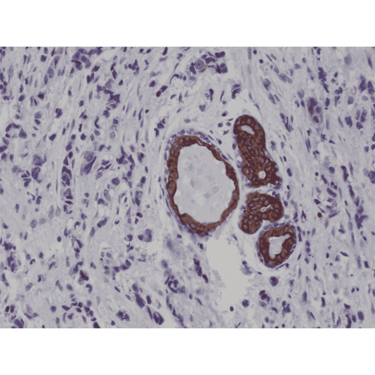 Immunohistochemistry - Anti-Cytokeratin 7 Antibody [RM284] (A121469) - Antibodies.com