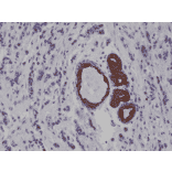 Immunohistochemistry - Anti-Cytokeratin 7 Antibody [RM284] (A121469) - Antibodies.com