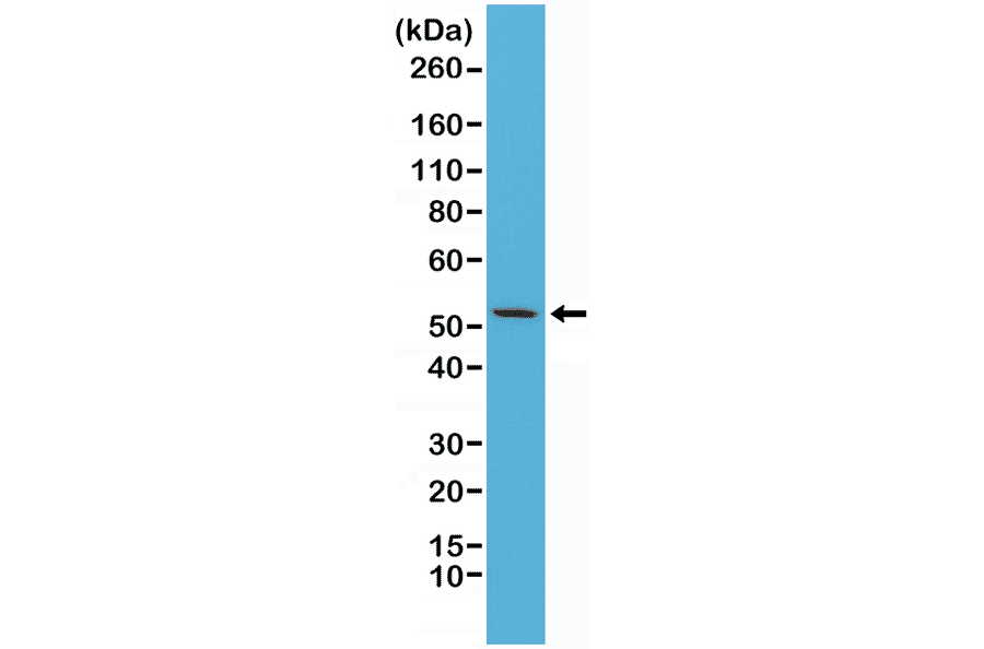 Western Blot - Anti-Cytokeratin 7 Antibody [RM284] (A121466) - Antibodies.com