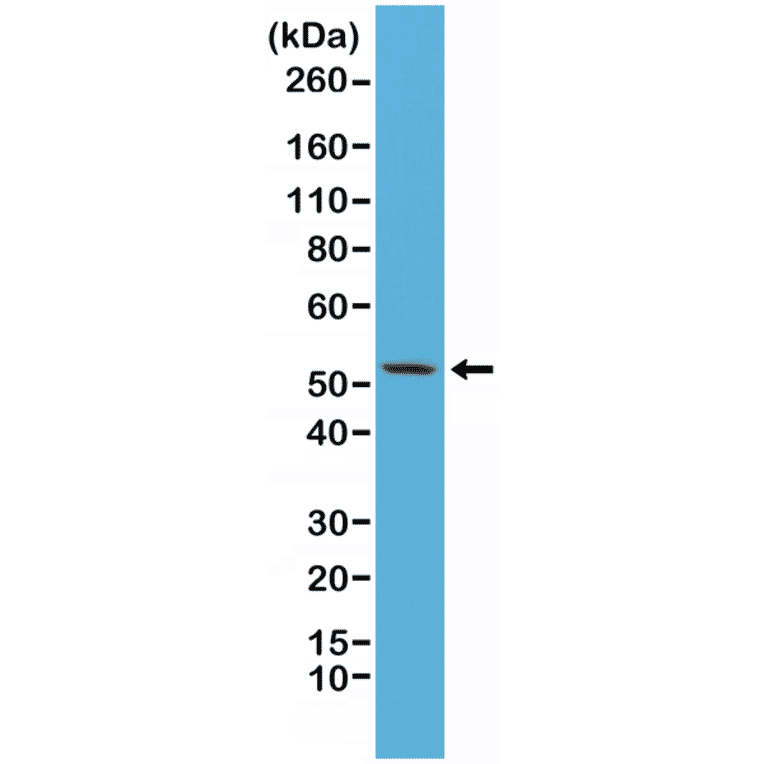 Western Blot - Anti-Cytokeratin 7 Antibody [RM284] (A121466) - Antibodies.com