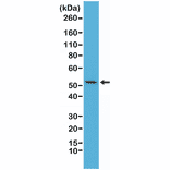 Western Blot - Anti-Cytokeratin 7 Antibody [RM284] (A121466) - Antibodies.com