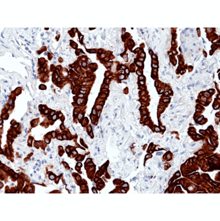 Immunohistochemistry - Anti-Cytokeratin 7 Antibody [RM416] (A121429) - Antibodies.com