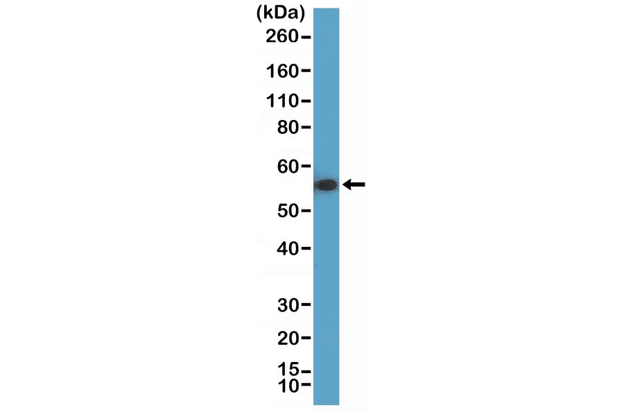 Western Blot - Anti-Cytokeratin 7 Antibody [RM416] (A121467) - Antibodies.com