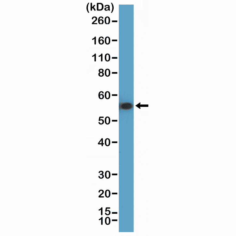 Western Blot - Anti-Cytokeratin 7 Antibody [RM416] (A121467) - Antibodies.com