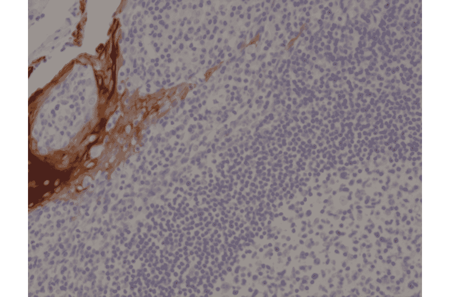 Immunohistochemistry - Anti-Cytokeratin 4 Antibody [RM355] (A121480) - Antibodies.com