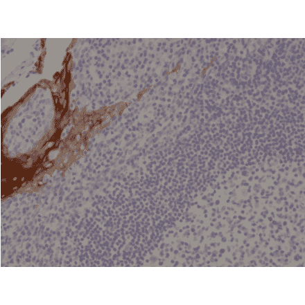 Immunohistochemistry - Anti-Cytokeratin 4 Antibody [RM355] (A121480) - Antibodies.com