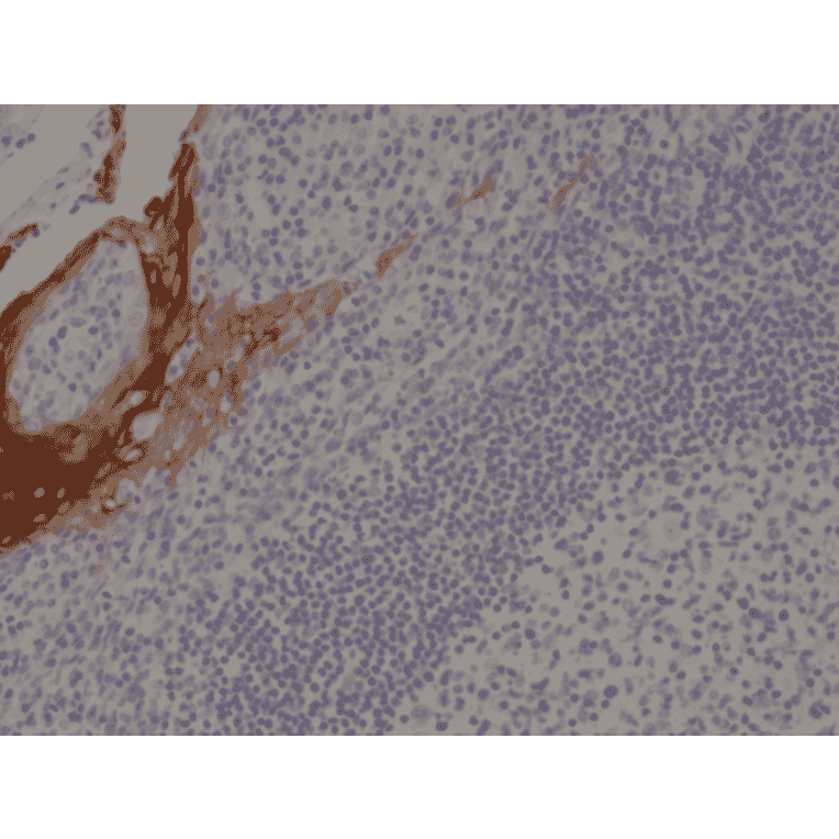 Immunohistochemistry - Anti-Cytokeratin 4 Antibody [RM355] (A121480) - Antibodies.com